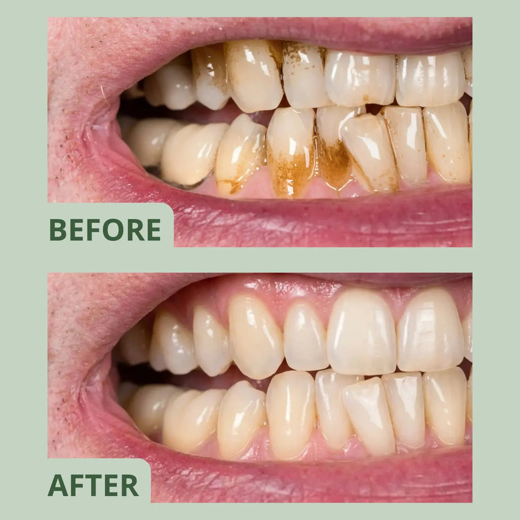 Glowlie - Clean Gum for Smokers