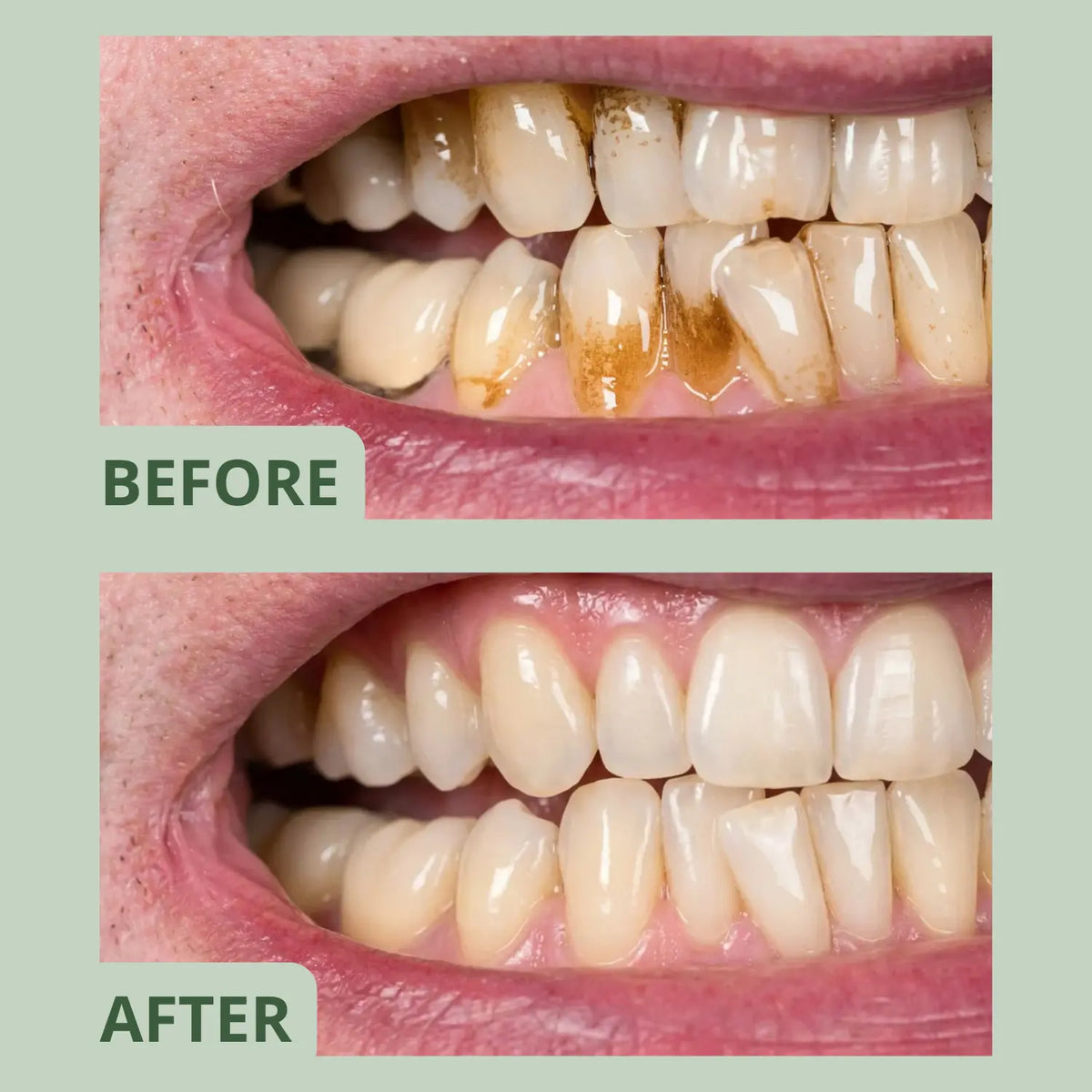 Glowlie - Clean Gum for Smokers