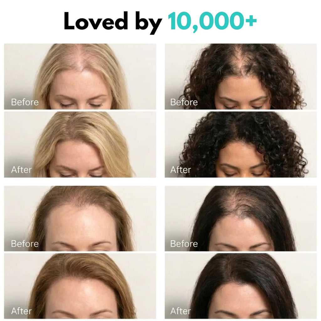 Korean Root Reboot PDRN Microneedling