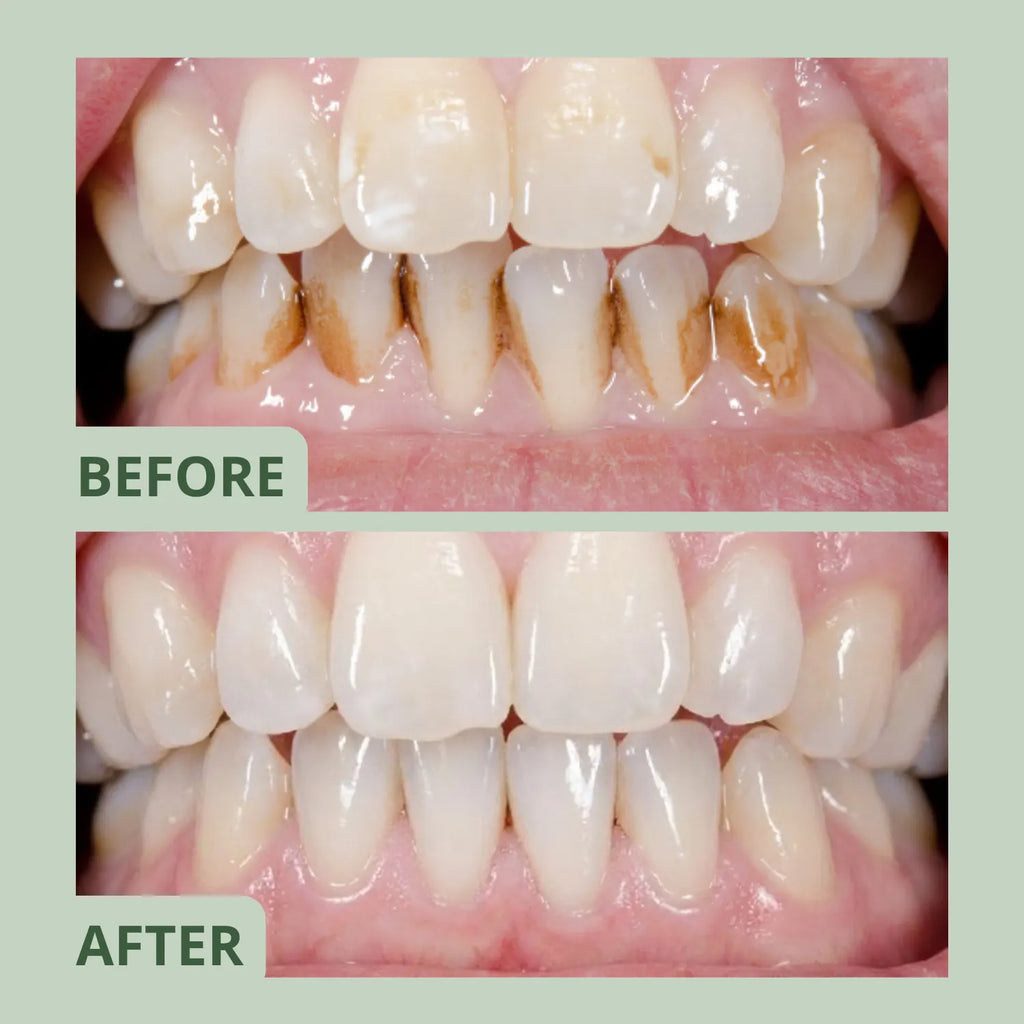 Glowlie - Clean Gum for Smokers