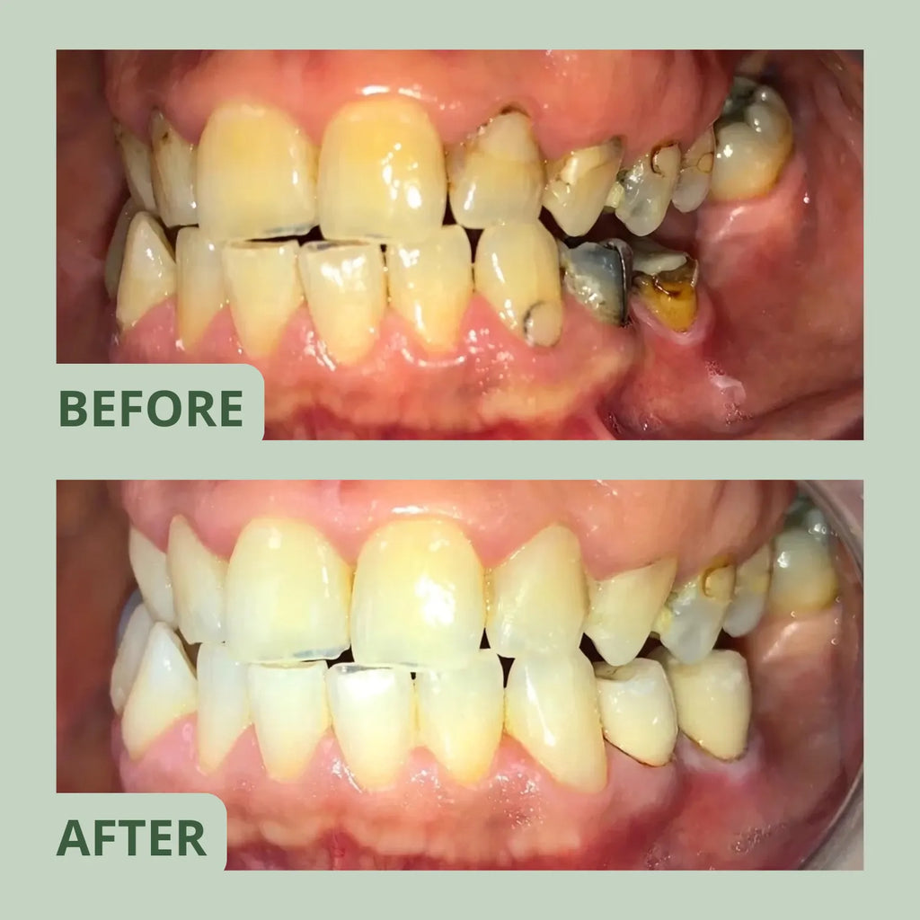 Glowlie - Clean Gum for Smokers