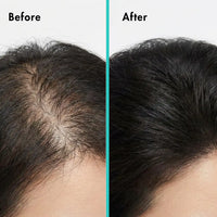 Korean Root Reboot PDRN Microneedling